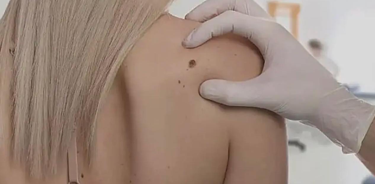 Esame dermatologico